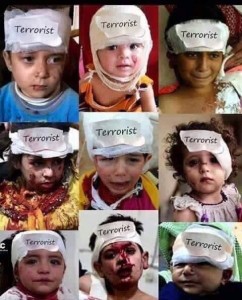 Siria bambini feriti considerati terroristi ai russi. Foto tratta da Genocyde in Siria
